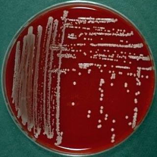 (4MRGN) Green Streptococci Coagulase negative staphylococci Staphylococcus aureus