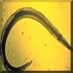 Pinworms Roundworm Most common helminth Usually affects