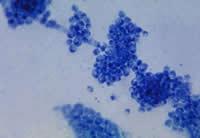 Fungi Candida Albicans They usually are not pathogenic & the body s