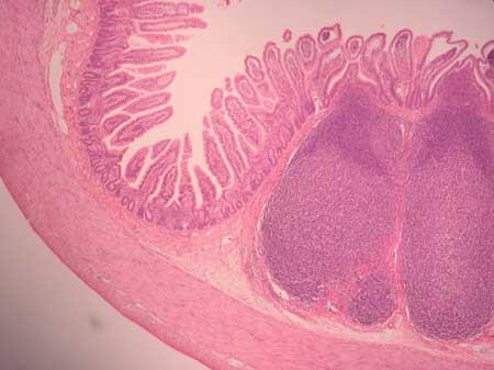 Now look back at Image A. See the muscularis mucosa? Then study the Ileum slide at low or medium power (Image C). Find the lumen.