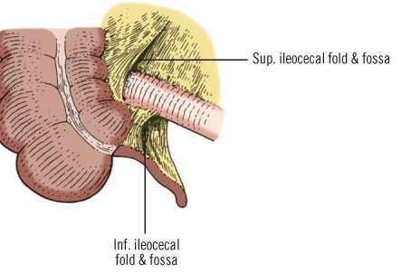 Peritoneal Fossae / Recesses: Caecal recesses Types