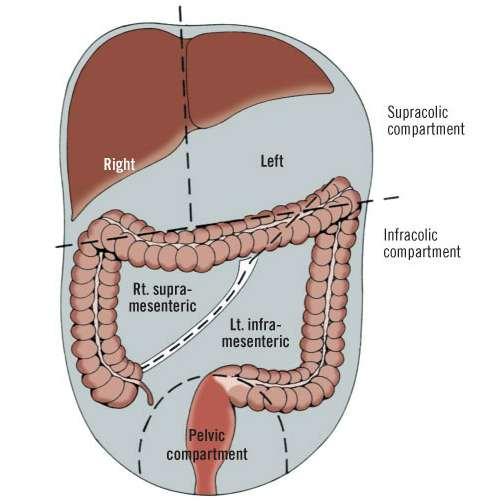 Peritoneal Compartments Supra Colic i. Right supracolic (a) Rt & Left sub diaphragmatic space (b) Rt & Lt Sub hepatic spaces ii.