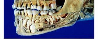 Teeth (Mastication = chewing) 8