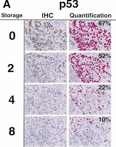 Paraffin Section Storage and Immunohistochemistry: Effects of Time, Temperature, Fixation, and Retrieval Protocol with Emphasis on p53