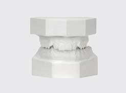 The engraved midline allows a precise centered or ex-centric positioning of the upper dental arch.