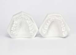 which securely fixes the upper dental plaster arch.