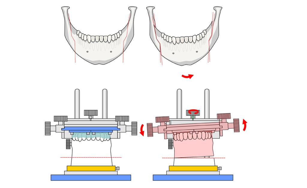 controlled manner and are completely reproducible, facilitating the creation of high-precision surgical guides. Their creation is also very fast and low cost.