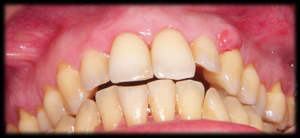 maloclusion and multiple