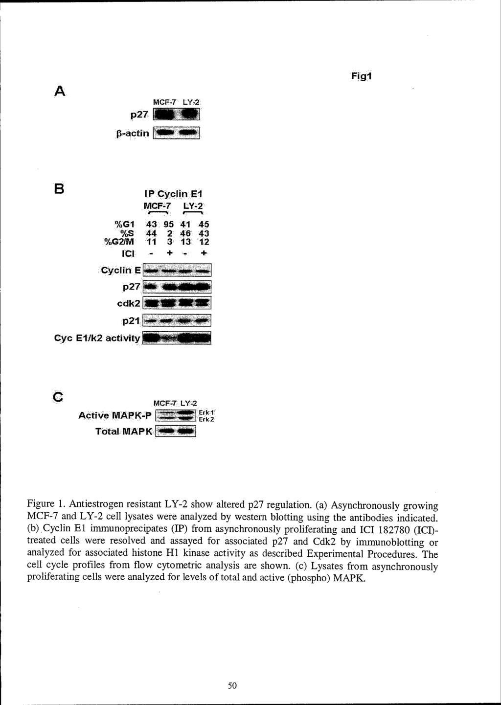 A p27 MGF-7 LY-2 Fig1 ß-actin B IP Cyclin E1 MCF-7 L.