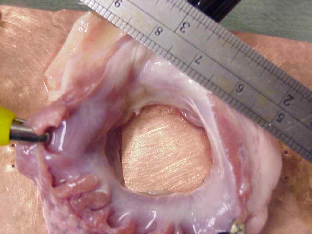 Annulus Contraction in Sheep