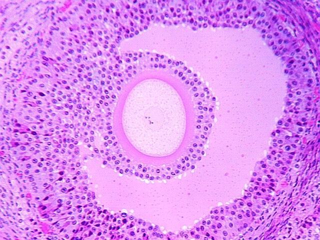 Cumulus cells as non-invasive predictor of oocyte/embryo quality Thomas EBNER Landes- Frauen- and Kinderklinik