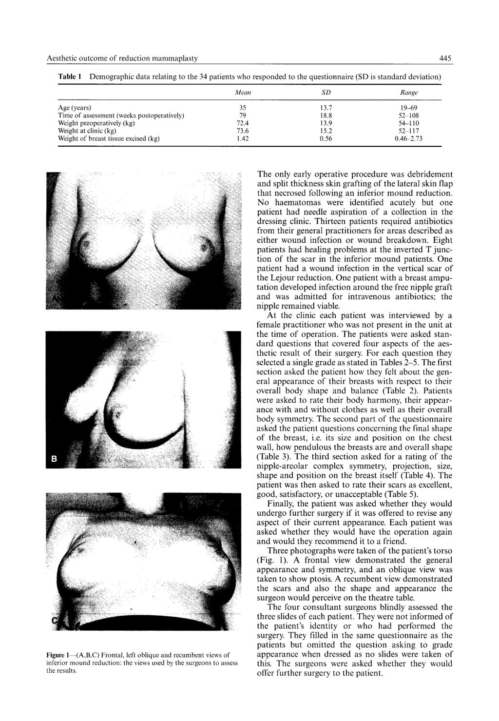 Aesthetic outcome of reduction mammaplasty 445 Table 1 Demographic data relating to the 34 patients who responded to the questionnaire (SD is standard deviation) Mean SD Range Age (years) Time of