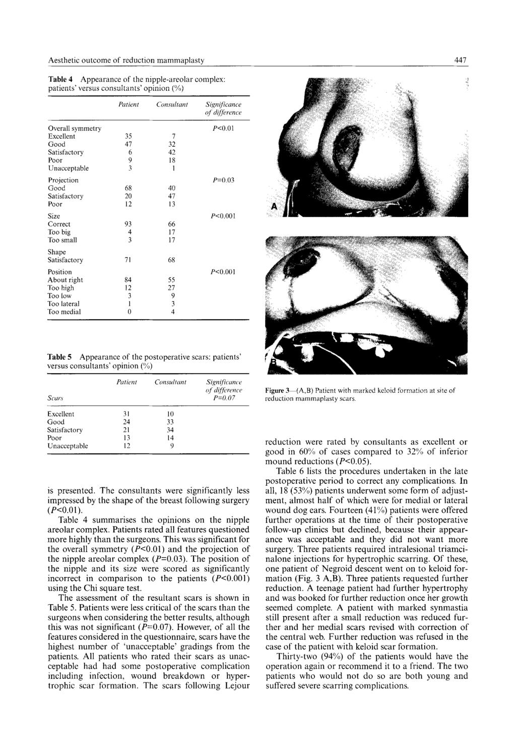 Aesthetic outcome of reduction mammaplasty 447 Table 4 Appearance of the nipple-areolar complex: patients' versus consultants' opinion (%) Patient ~imsultant SigniJicance of diffi, rence Overall