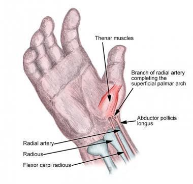 After the radial artery, the femoral artery is the second most common site for arterial cannulation.