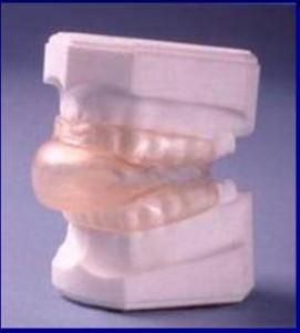 Oral Appliance Therapy [OAT] 3 methods Mandibular Repositioning Appliances (MRA): advance mandible in a protrusive position Tongue Retaining Device