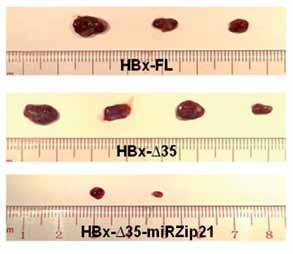 # Hepatitis B viral X protein/microrna-21 interaction # (a) (b) HBx-FL HBx- 35 mirzip-21 (c) (d) (e) (f) FIG 3.