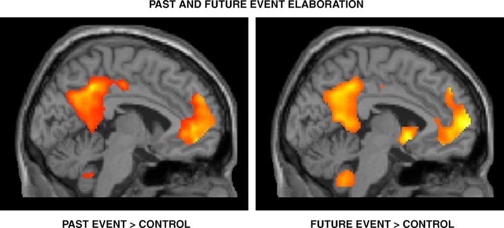 the striking commonalities in medial left prefrontal and parietal activity during the elaboration of (a) past and (b) future events (relative to the control tasks) From Addis, D.A., Wong, A.