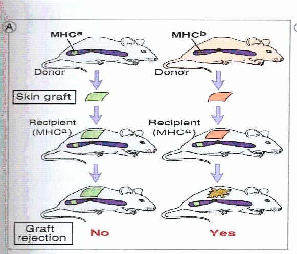 Rejection First Set Rejection Skin graft in mice 7-10 days Second Set Rejection Skin graft in mice in 2-3 days Foreign