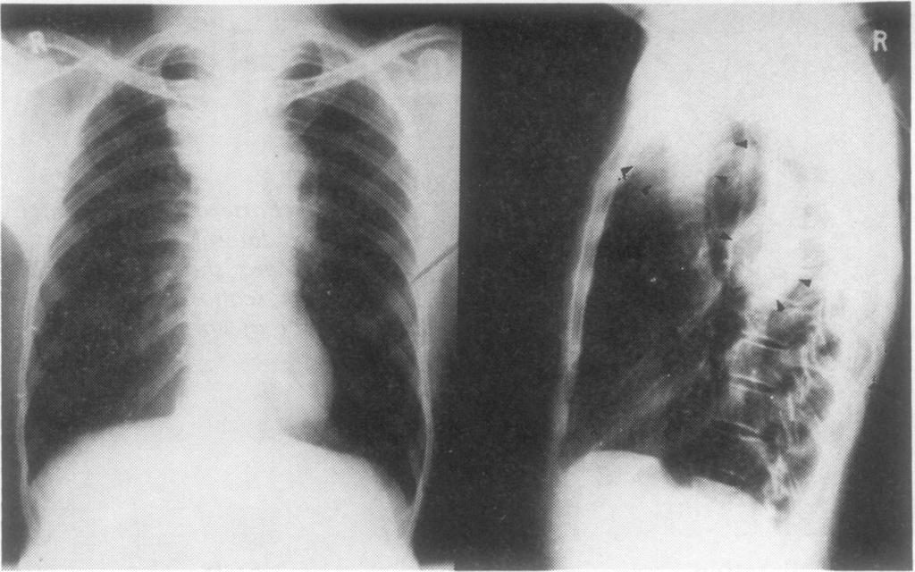470 not be a-pparent on the conventional chest radiographs.