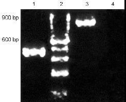 Agarose gel electrophoresis for detecting DNA fragmentation induced by Des 40 m mol/l. Lane 1: control; Lane 2: Des 40 m mol/l; Lane 3: 100 bp Marker.
