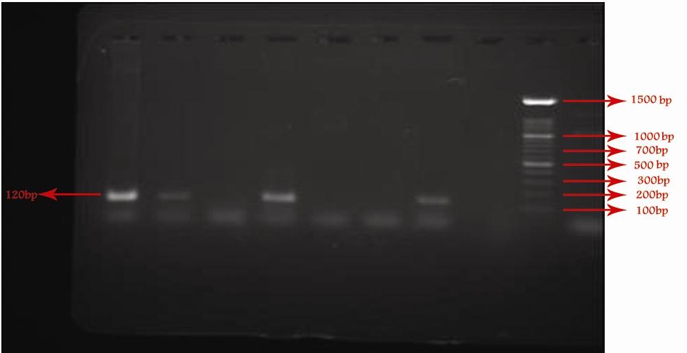 Abcd 34 Fig. 1: Gel electrophoresis of products of PCR with kdna primer using the phenol chloroform extracted samples.