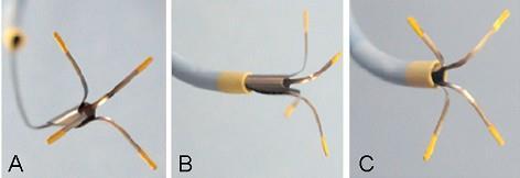 Stent catheter Bending of anchoring wire at ostium Ostial