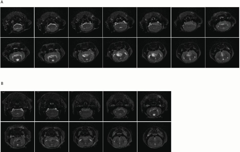 Figure S5: Representative MRI of MCF7-HER2-BR3 metastases in the brains of nude mice. The mice were anesthetized with isoflurane and placed in the MRI coil in a supine position.