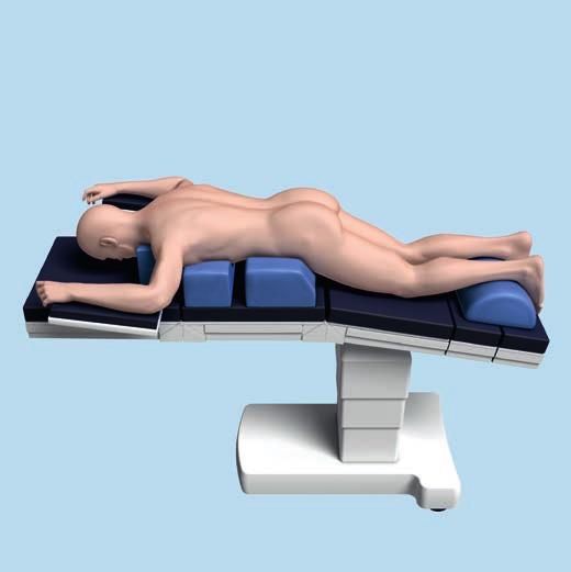 Fibula plate Position the patient supine on a radiolucent operating table with a sandbag (bump) underneath the buttock of the affected side.