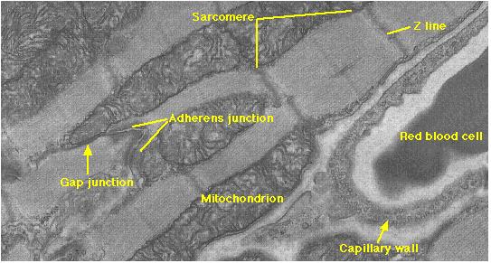 Zigzag- like structure, Step-Like structure connecting two cardiac muscle cells together, it has two parts: Horizontal Part. Vertical Part. Muscle tissue It contains 3 types of junctions: A.