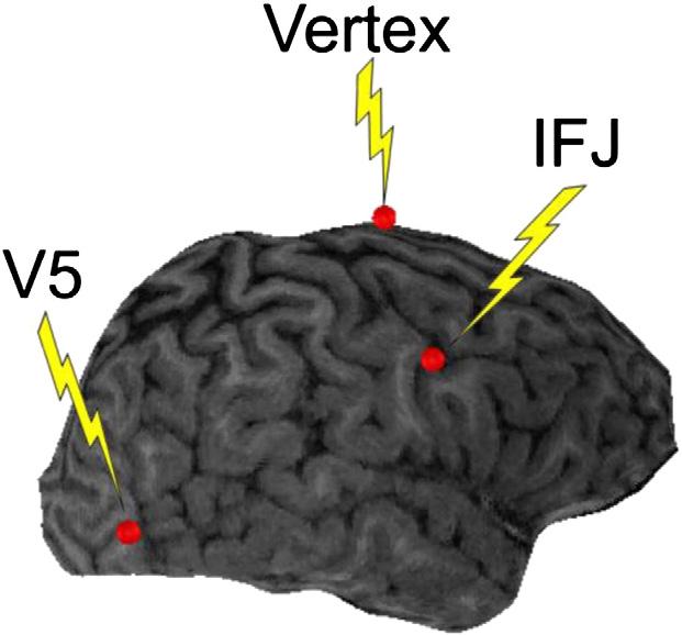 798 T.P. Zanto et al. / NeuroImage 85 (2014) 794 802 Event related potentials Fig. 2. Targets for sptms.