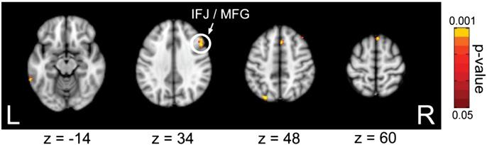 800 T.P. Zanto et al. / NeuroImage 85 (2014) 794 802 Fig. 5. Phase based effects of sptms on P1 amplitude to probe stimuli. Similar to sptms effects on RT (see Fig.