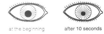 Controls the thickness of the eye lens Arrange in sequence the thickness of his eye lens based on his actions A. XZ C. ZX B. ZX D. ZX 6. Diagram shows a change in the size of a pupil 2.