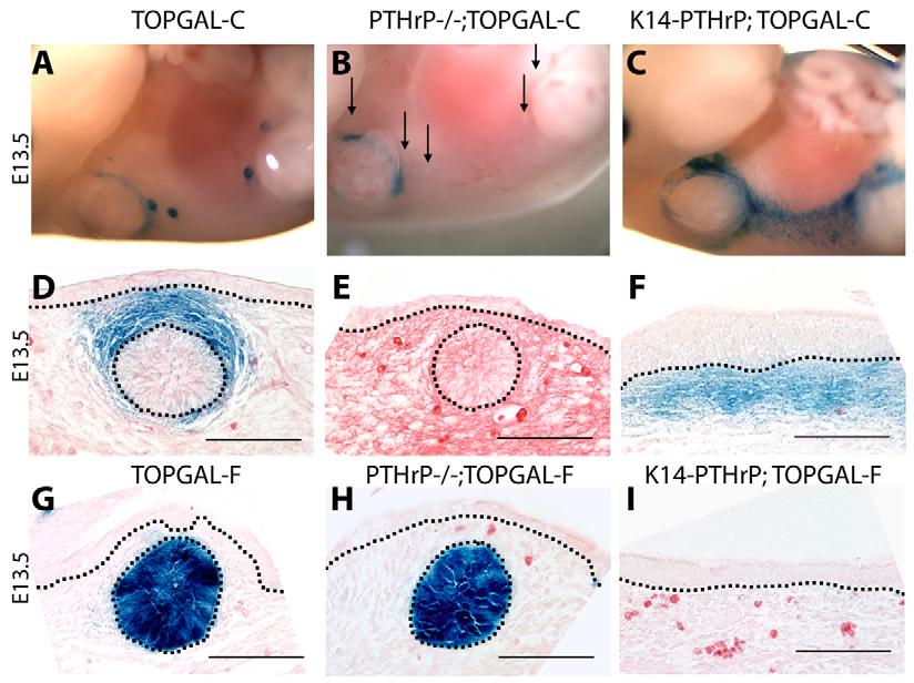 PTHrP-Wnt in mammary mesenchyme RESEARCH ARTICLE 4241 Epidermal thickness was measured at three equidistant points that were determined by overlaying the images with a grid, to ensure random sampling.
