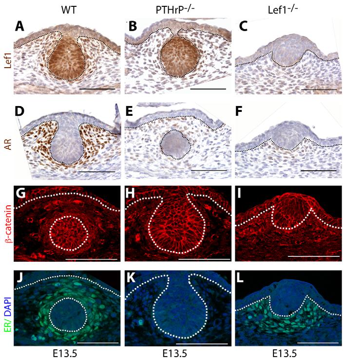 at E15.5. (B,F) Loss of Lef1 does not alter the ectopic Wnt signaling that is induced by PTHrP-overexpression.