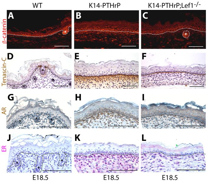 PTHrP-Wnt in mammary mesenchyme RESEARCH ARTICLE 4243 al., 2001).