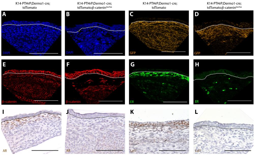 PTHrP-Wnt in mammary mesenchyme RESEARCH ARTICLE 4247 Fig. 10. -catenin is required for K14- PTHrP-mediated ectopic mammary mesenchyme specification. (A-L) Ventral skin harvested from E13.