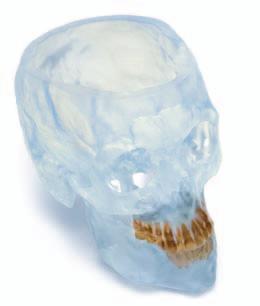 Synthes ProPlan CMF. Planning service and patient-specific products for craniomaxillofacial surgery.