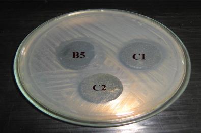 Analysis of Antibacterial activity by ENISO 2645 for the fabrics finished under five different conditions Against Escherichia coli Against Staphylococcus aureus A1-2kgf/cm 2, 2m/min, A2-2kgf/cm 2,