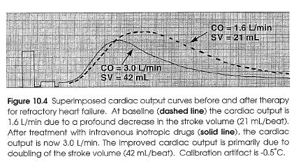 Chronic Congestive Heart Failure Cardiac Output/Index Are usually reduced with the average being 3.0 L/min and 1.6 L/min/m2 respectively.
