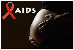 Historical Perspective (HIV/AIDS) AIDS epidemic surfaced nearly 31 years