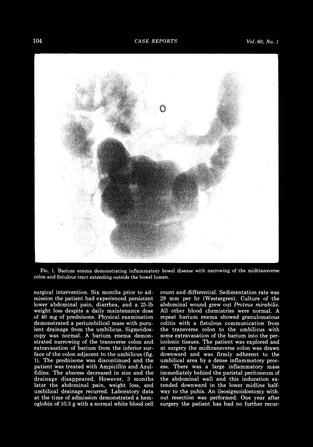 104 CASE REPORTS Vol. 60, No.1 FIG. 1. Barium enema demonstrating inflammatory bowel disease with narrowing of the midtransverse colon and fistulous tract extending outside the bowel lumen.