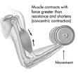 Types of muscle contraction Concentric contractions involve muscle developing tension as it shortens Eccentric contractions involve the muscle lengthening under tension Modified from Shier D, Butler