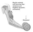 2-37 Types of muscle contraction Concentric contraction muscle develops tension as it shortens occurs when muscle develops enough force to overcome applied resistance causes movement against gravity