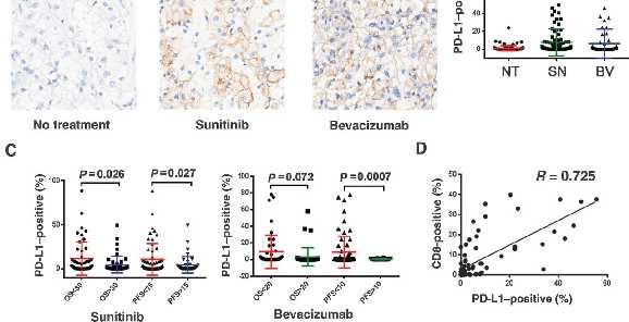 with sunitinib or bevacizumab were IHC stained with anti PD-L1 antibody.