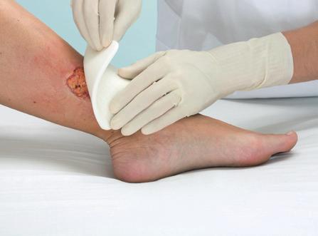 bed as they impair wound healing and hinder the assessment of wound size and depth. Hydrogels provide an effective yet gentle method to dissolve necrotic and sloughy tissue.