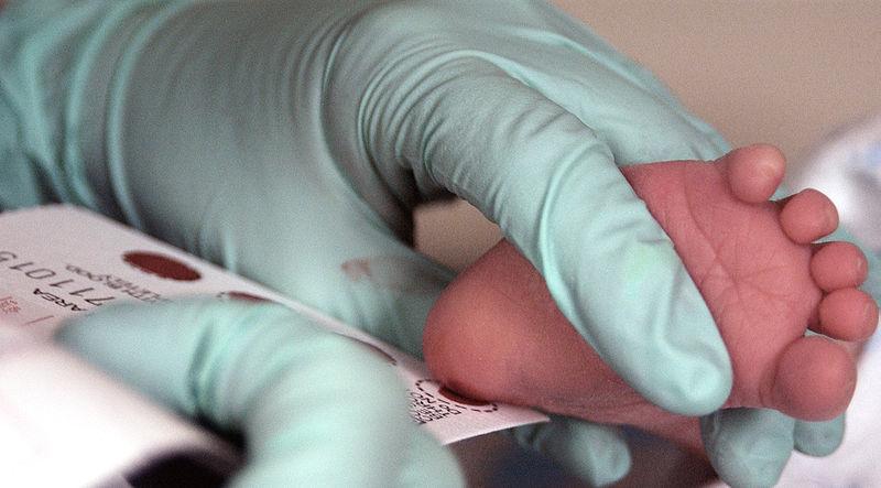 Newborn screening All newborns in the state of Massachusetts are screened for 30 common genetic disease