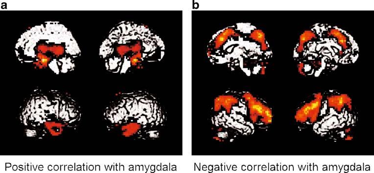 Brain Imaging and Behavior (2010) 4:96 108 105 Fig. 6 Functional connectivity maps for the amygdala across experimental conditions (FDRcorrected threshold of p<.05).