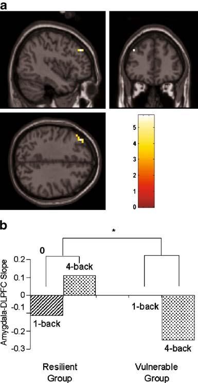 Inspection of the individual condition slopes for this group indicated that the activities of the amygdala and DLPFC were inversely related (negative slope) in the 1-back condition but directly