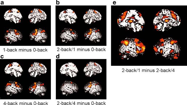 102 Brain Imaging and Behavior (2010) 4:96 108 Fig. 3 N-back activation maps at different loads. a d Brain activation during the 1-back, 2- back/1, 4-back, and 2-back/4 conditions.