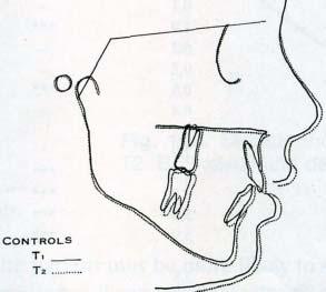 upper and lower molars (Fig. 10).